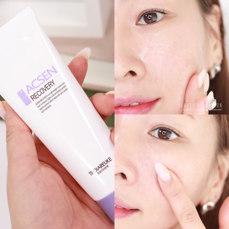 피부장벽크림 트로이아르케 악센 리커버리 예민피부 관리중 피부장벽크림 트로이아르케 악센 리커버리 예민피부 관리중