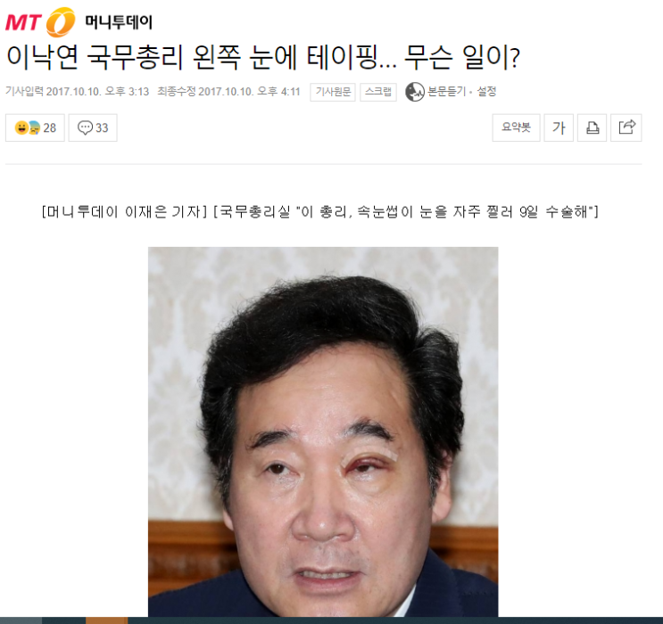 블랙아이클럽/ 누가 그들의 눈탱이를 때렸나. 눈탱이 밤탱이 일루미나티 다이아몬드? 클럽 가입의식 -교황 눈에 멍-차기 대통령