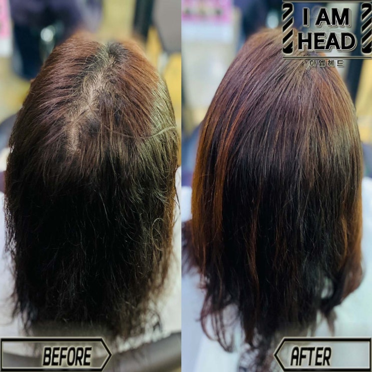  웨이브펌과 모류교정 조합!! S컬펌+가르마교정 링거펌전문점 수원미용실 아엠헤드