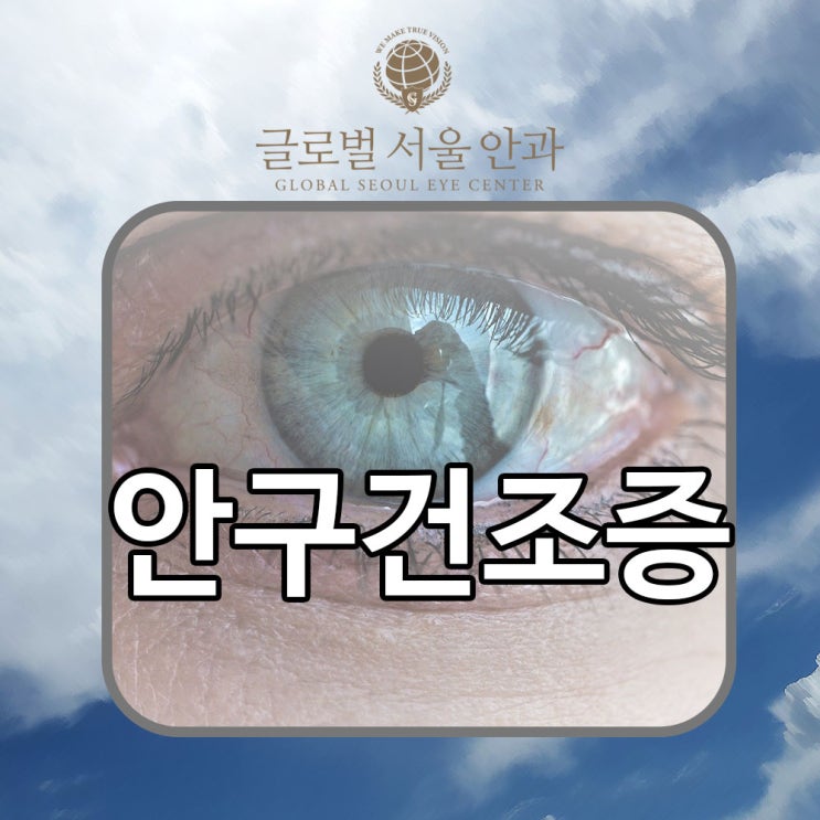 강남안과 안구건조증 치료 강남안과 안구건조증 치료