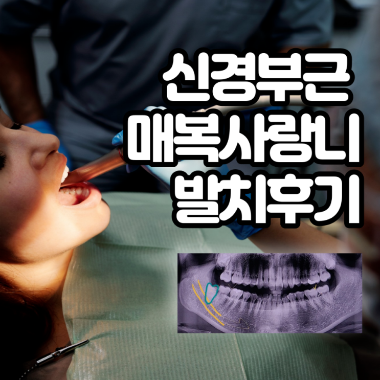  서울 노원)오른쪽 신경 완전매복사랑니 발치 첫날, 둘째날 소독 후기, 다인치과
