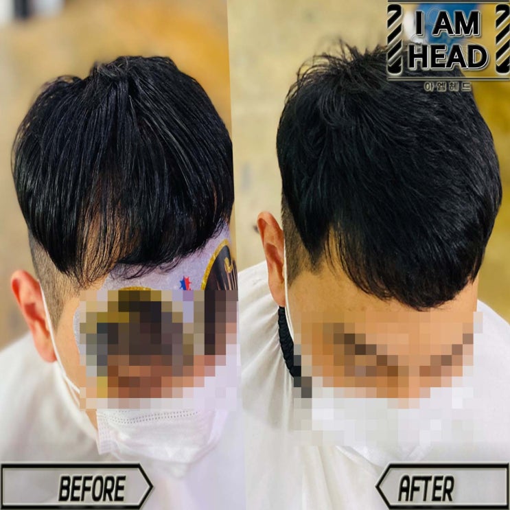  M자탈모 납작두상 링거펌으로 뿌리볼륨만들기! 링거펌전문점 수원미용실 아엠헤드