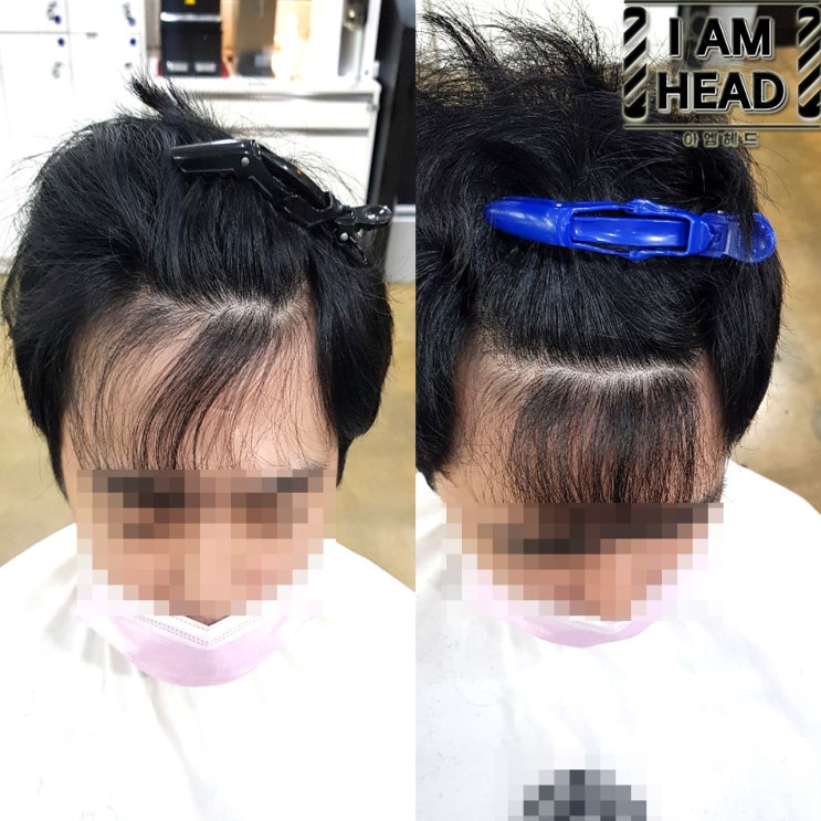 앞머리교정 링거펌 시술후기 - 링거펌전문점 수원미용실 아엠헤드
