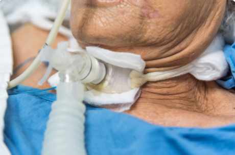  기관절개관, 기관절개 튜브(tracheostomy tube) 에 관하여 : 종류와 크기, 압력에 대해서