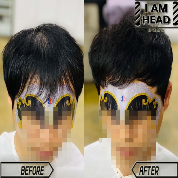  탈모커버 탈모펌잘하는곳 !! 링거펌전문점 수원미용실 아엠헤드 !!