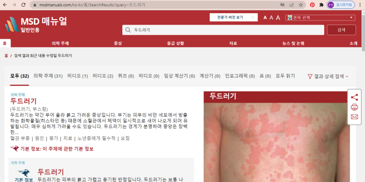  [MSD매뉴얼] 질병에 대한 궁금증 #MSD매뉴얼에 다 있다.