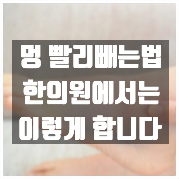  멍 빨리 빼는법, 한의원에서는 이렇게 합니다