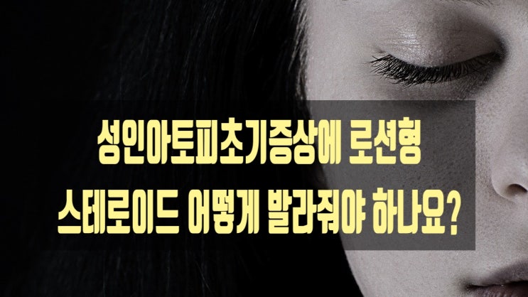  성인아토피초기증상에 로션형 스테로이드 어떻게 발라줘야 하나요?