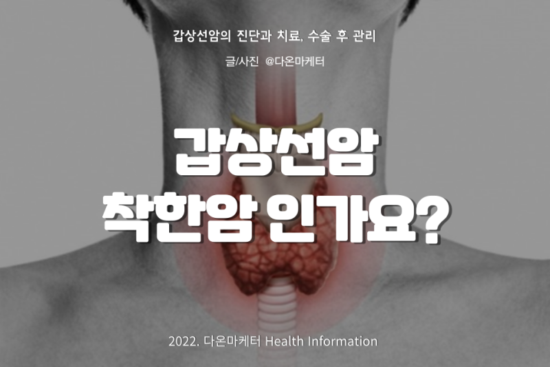 갑상선암은 착한 암이 맞을까?  |  수술 및 항암치료 후 관리법