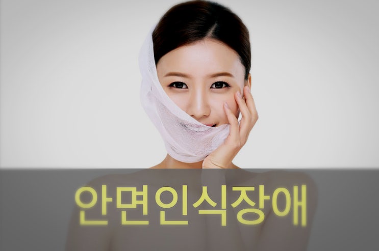  누구세요? 안면인식장애, 안면실인증 원인과 증상
