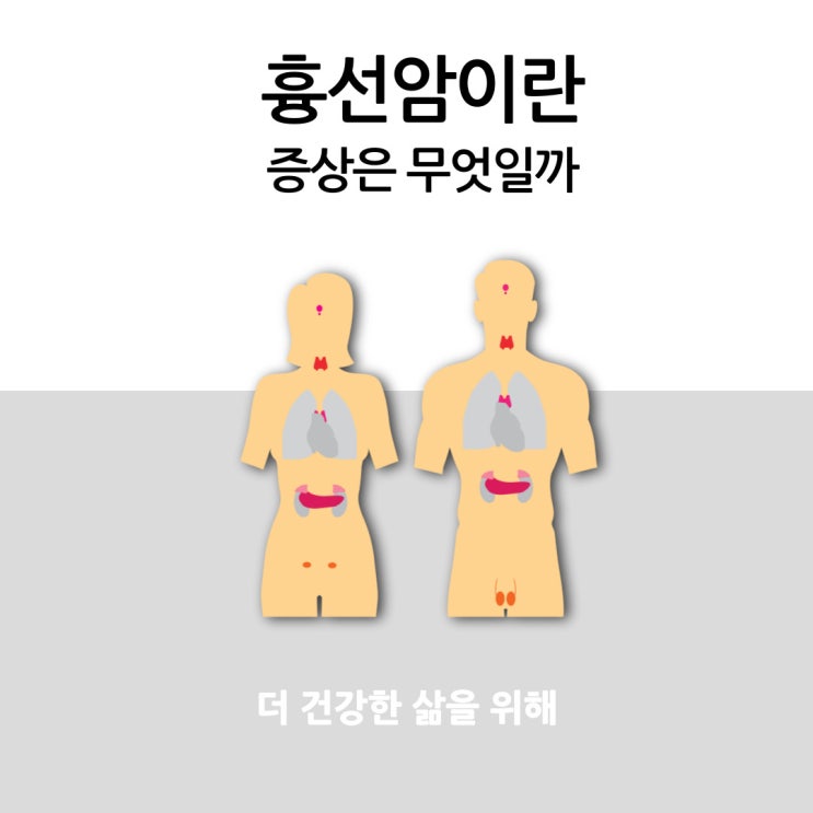 흉선암 어떤 것일까요? 증상도 함께 알아보세요