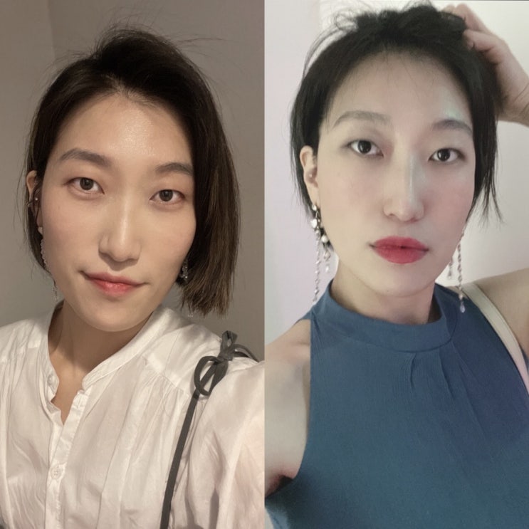  [피부과]풀페이스 인모드 리프팅 3회 + 에어젯 2회 시술 후기
