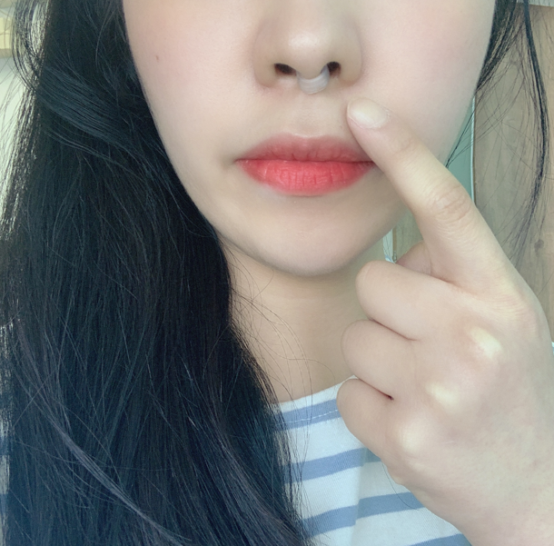  신랑의 심한 코골이 바로 잡은 후기