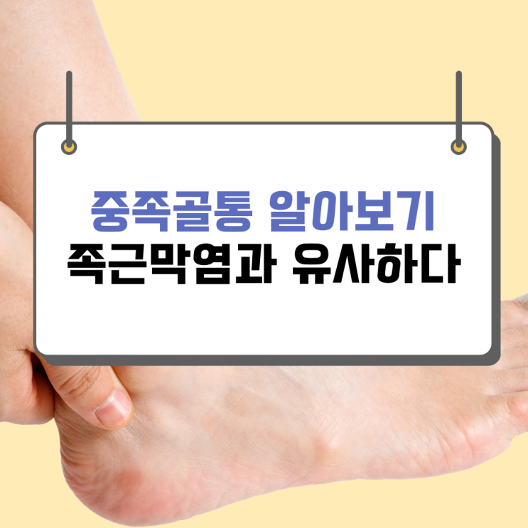  중족골통은 근족막염과 관련이 있을 수 있다 (ft. 발바닥이 아프다)