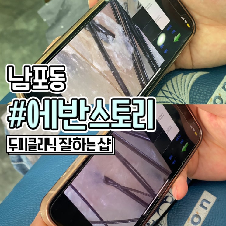  남포동 미용실 두피클리닉 잘하는 에반스토리