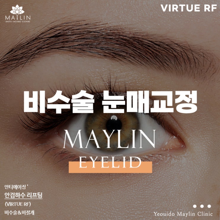  여의도 비수술 눈매교정 (안검하수) 또렷한 눈매 되찾기!