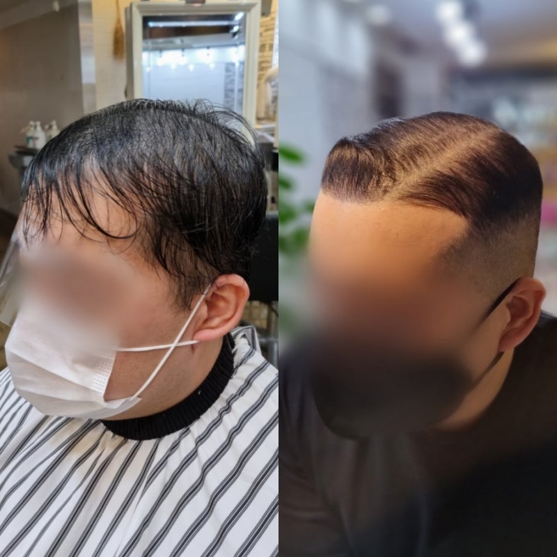 모발이식 후 추천하는 페이드컷 테이퍼 페이드 (사이드파트) - 하남 바버샵 미사 바버샵 - 지구에사는 모발이식 후 추천하는 페이드컷 테이퍼 페이드 (사이드파트) - 하남 바버샵 미사 바버샵 - 지구에사는