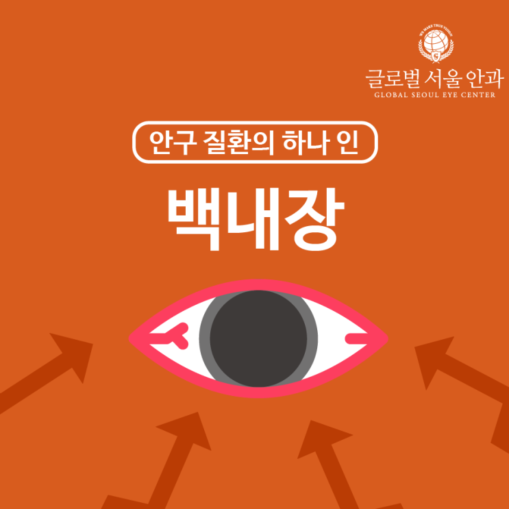  백내장 수술 미리 알아보고 치료