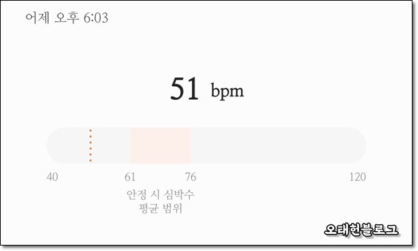  심장 두근거림, 두근거리는 느낌이 드는데 심계항진인가 부정맥인가