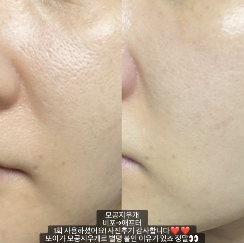 결점을 커버하는 홀 패드와 버터플라이 부분도 잘 처리됩니다.