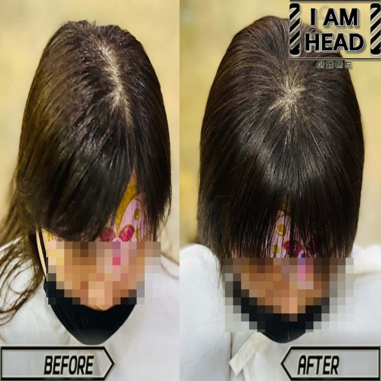  링거펌으로 두상성형하기!! 두상성형펌 링거펌전문점 수원미용실 아엠헤드