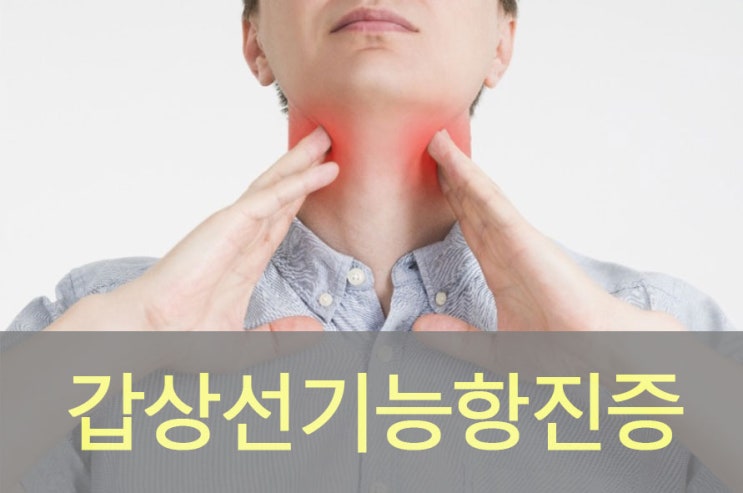  갑상선 질환 중 갑상선 기능 항진증(그레이브스병) 원인과 증상