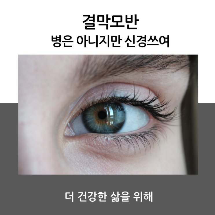 결막모반 병은 아니지만 신경 쓰여