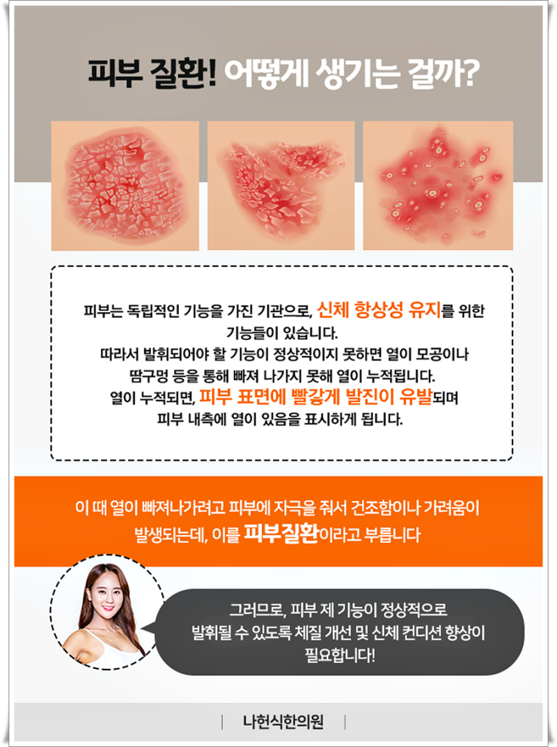 피부의 붉은 반점, 가려움증, 물집까지 생기면 이게 문제인가? 4