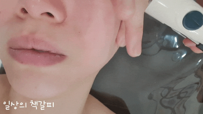  세종 피부관리 나성동 <아르 드 뽀 에스테틱>에서 게리종관리 홍조관리 했어요