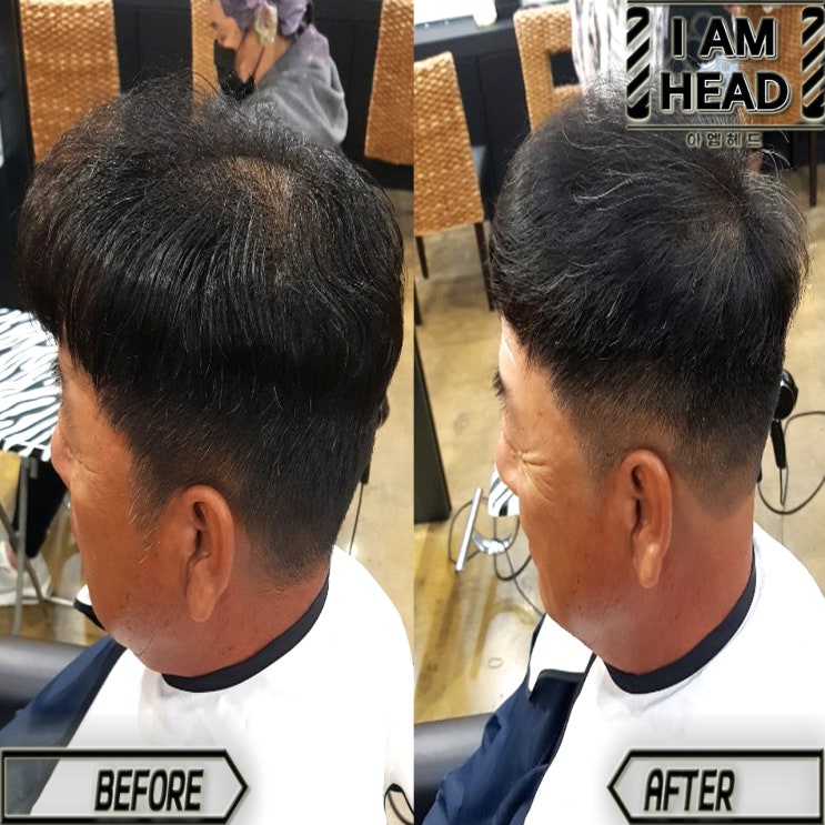  중년남성 휑한 정수리 모류교정으로 정수리커버하기! 링거펌전문점 수원미용실 아엠헤드