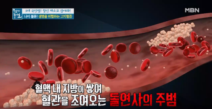  고지혈증에 도움이 되는 채소 : 생명을 위협하는 고지혈증