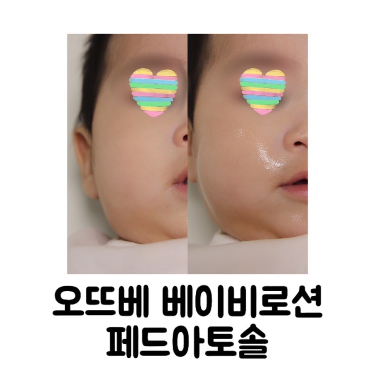  [육아템] 오뜨베 베이비로션 페드아토솔/아기 피부 트러블 원인 및 완화 방법