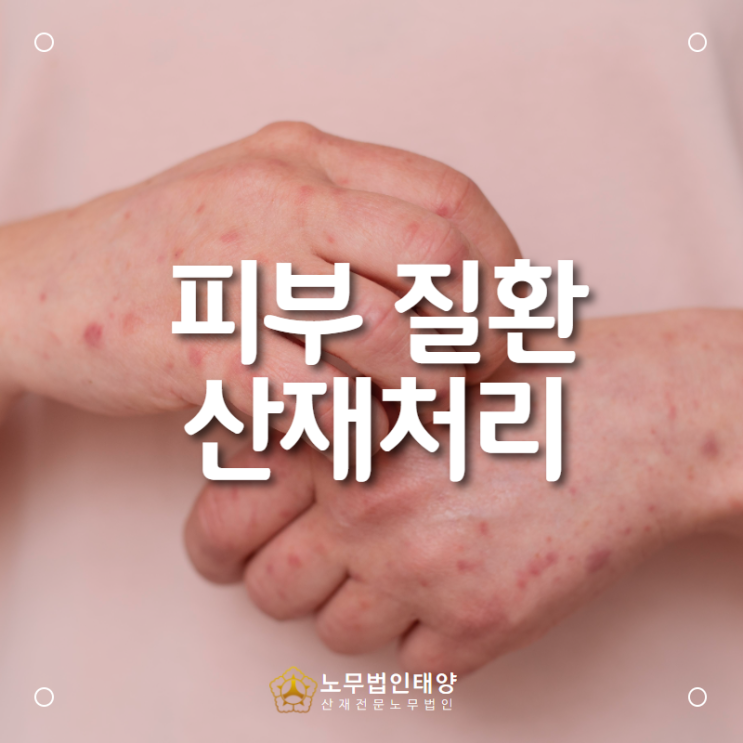  직업성 피부 질환, 스티븐스존슨 증후군 산재처리는 최대한 빠르게