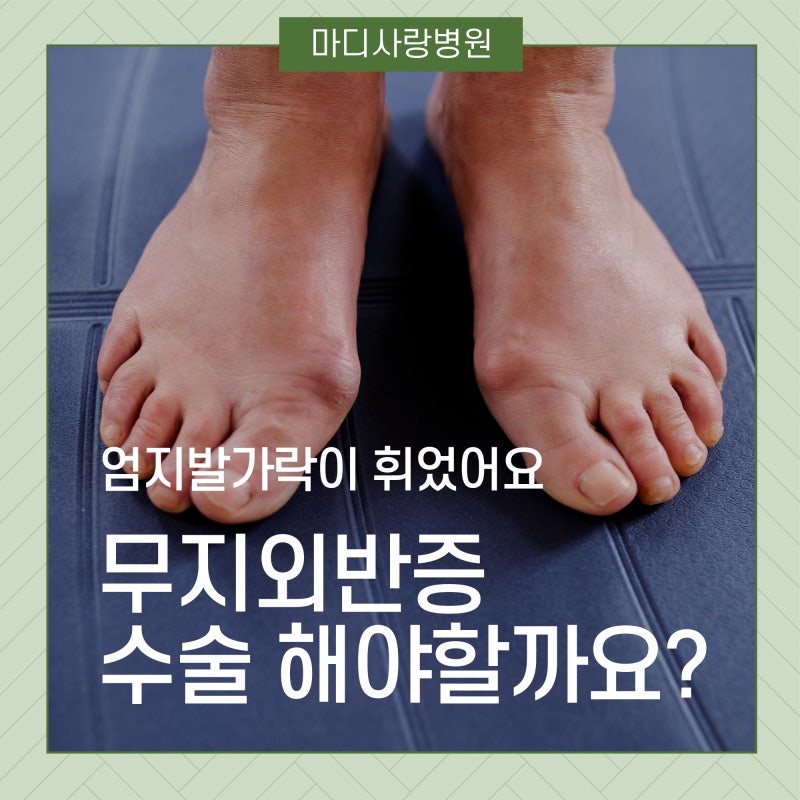 무지외반교정기 알리익스프레스에는 하나 달라?? 6