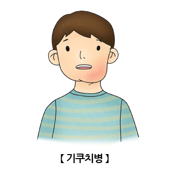  이유를 알수없는 턱밑 멍울 2탄 ft. 기쿠치/키쿠치병