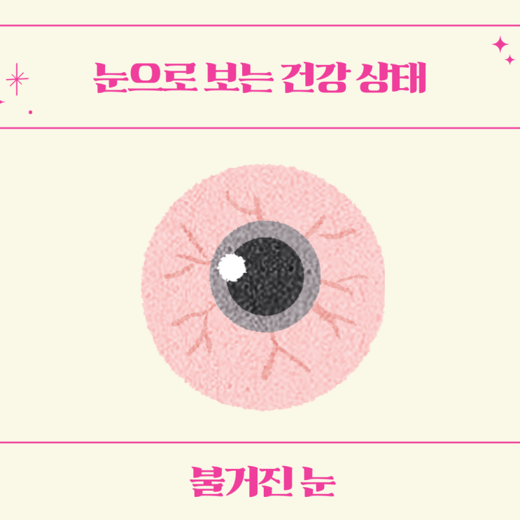  건강정보, 눈으로 보는 건강상태