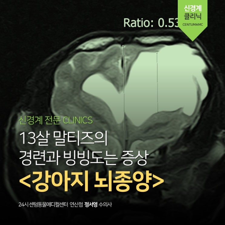  13살 말티즈 <강아지 뇌종양> 뇌수두증, 발작 (부산 신경 종양 전문 동물병원, 24시 센텀동물메디컬센터 연산점)