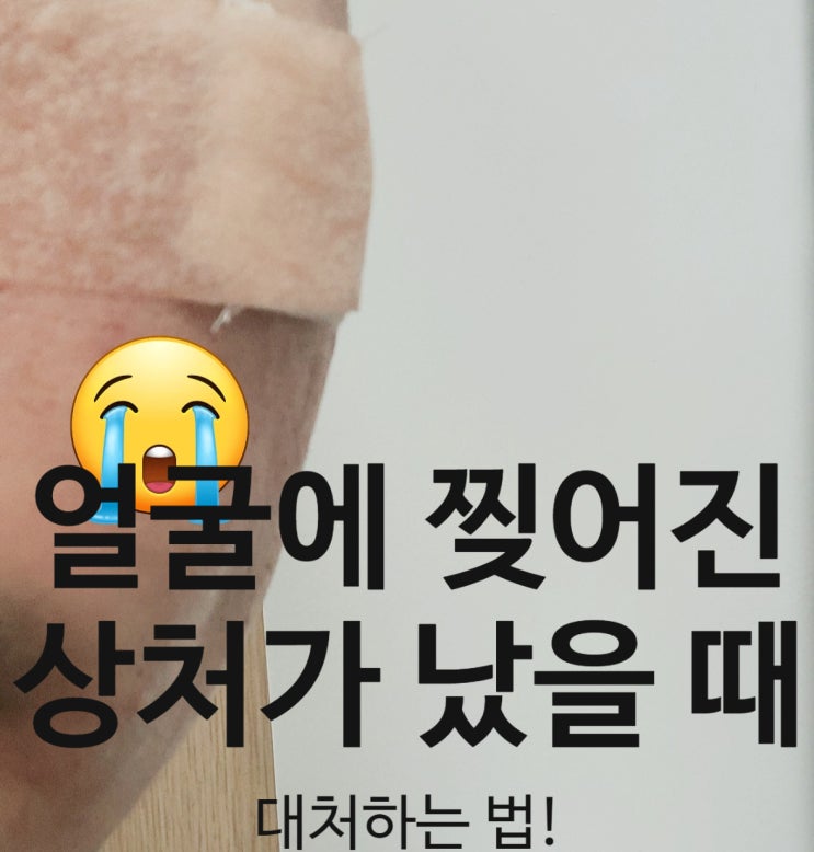  얼굴에 찢어진 상처가 났을 때 조치하는 법!