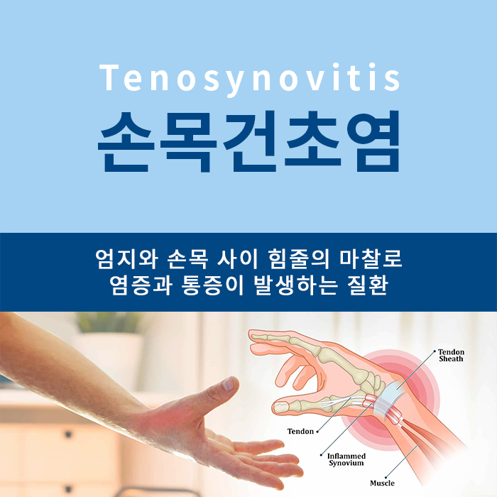 손목 통증, 염증 혹은 인대 파열? 11