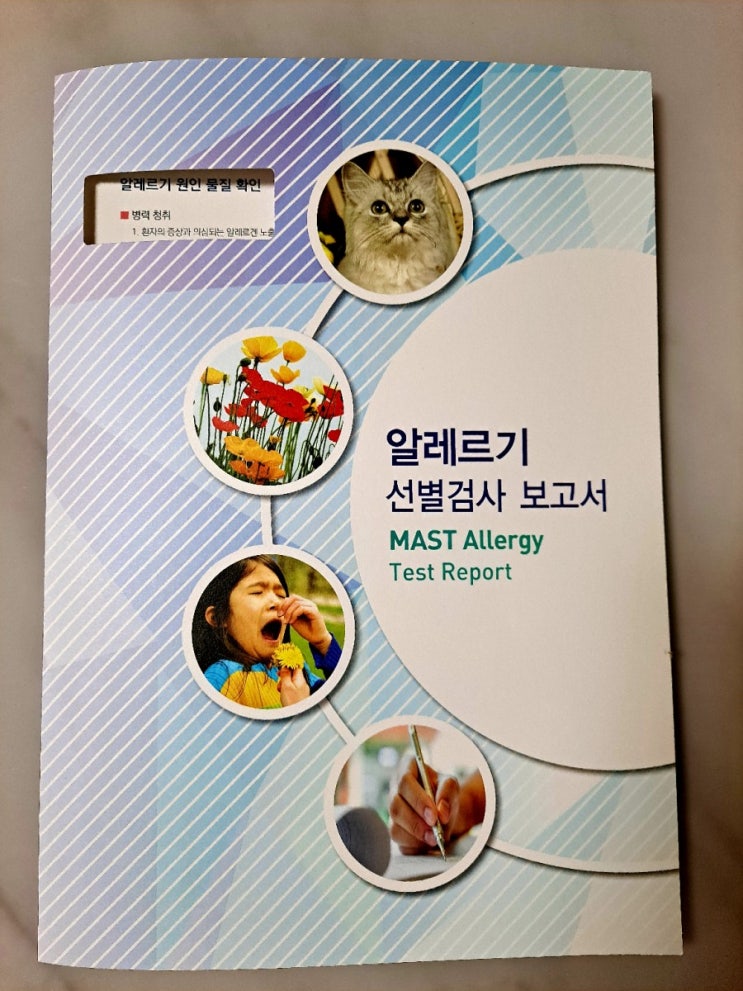  동탄 수내과에서 알레르기 검사 받아보았습니다