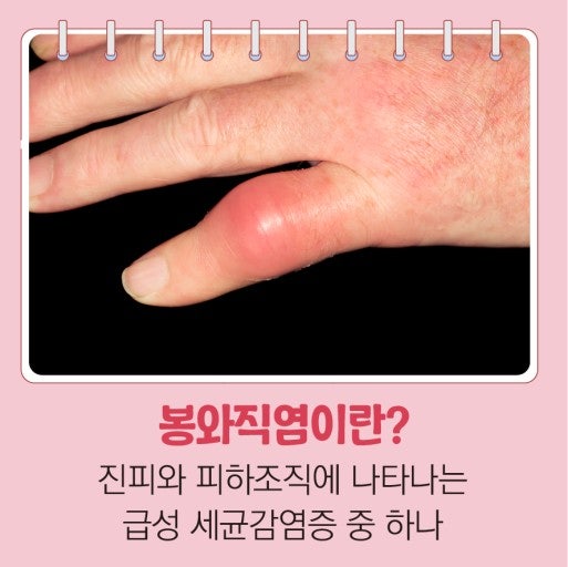신길동피부과 피부상처 염증 봉와직염 : 네이버 블로그
