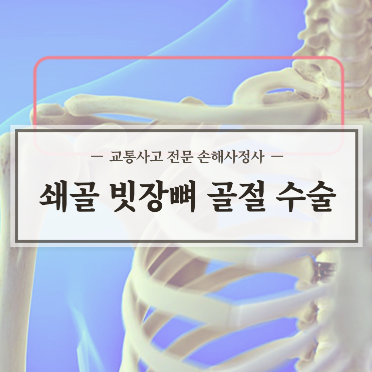  쇄골 빗장뼈 골절 교통사고 수술하면 달라질까요?나란히 파헤쳐요.
