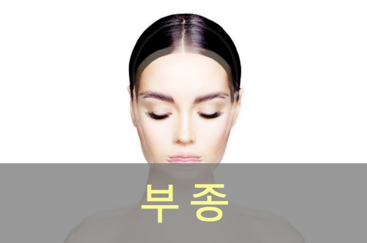  나! 살찐 거야? 부종 원인, 예방, 좋은 음식