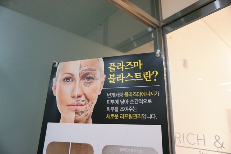  '리치앤도트' 천안플라즈마 기미잡티 관리 후기