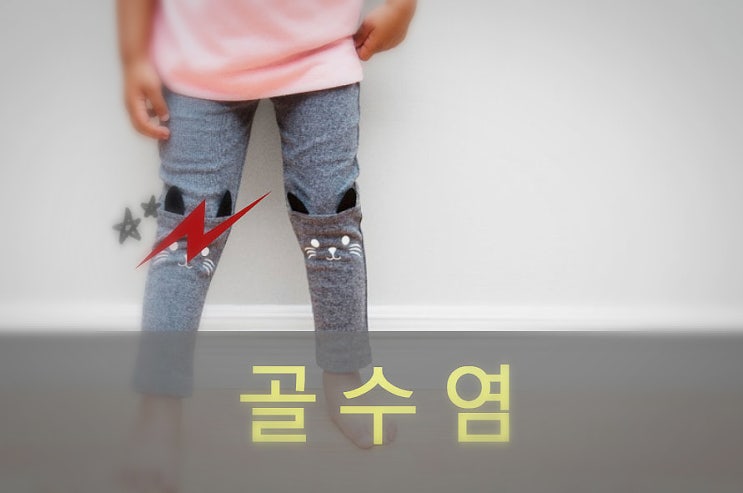  골수염 원인과 증상, 예방, 좋은 음식