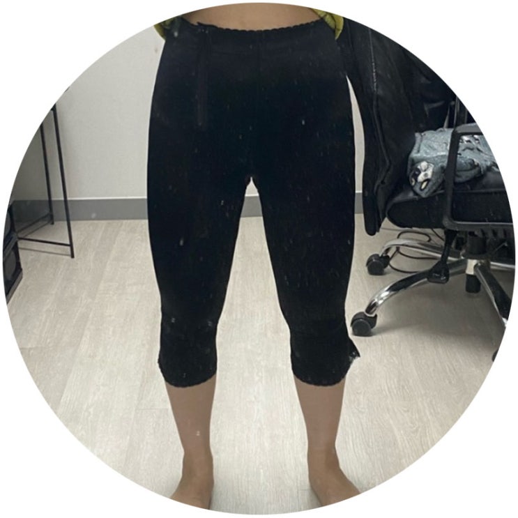  청주 무한람스 허벅지(지방흡입주사)내돈내산 후기 통증 붓기
