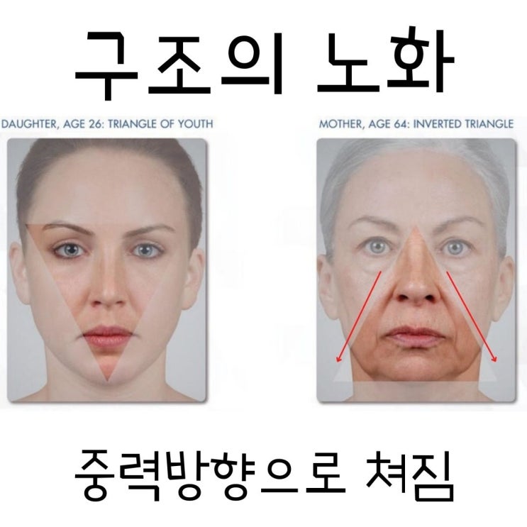  올큐어리프팅 강의를 듣고 와서