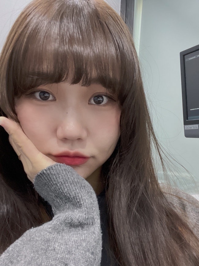 보조개 수술 3주차 후기 (개인적이고 현실적인 후기)