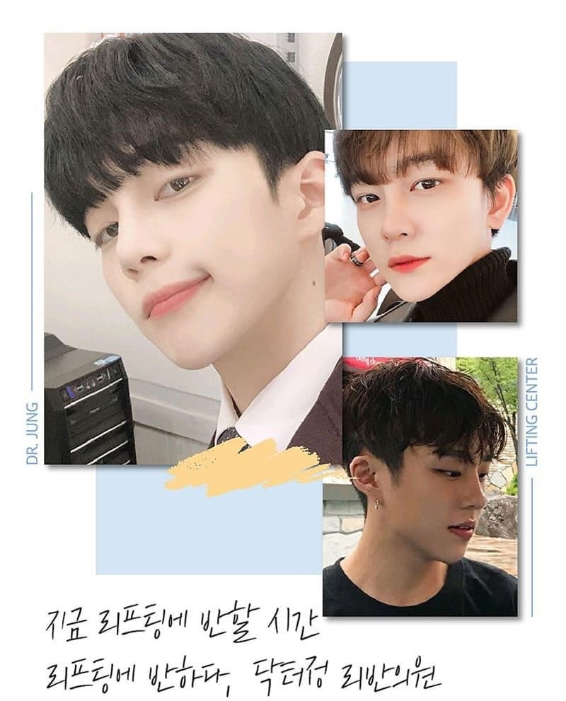 [이중턱근육묶기] 닥터정 리반의원의 2