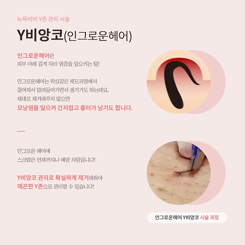 뉴욕비비 구미점 사진 6